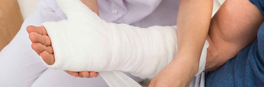 patient with a cast arm